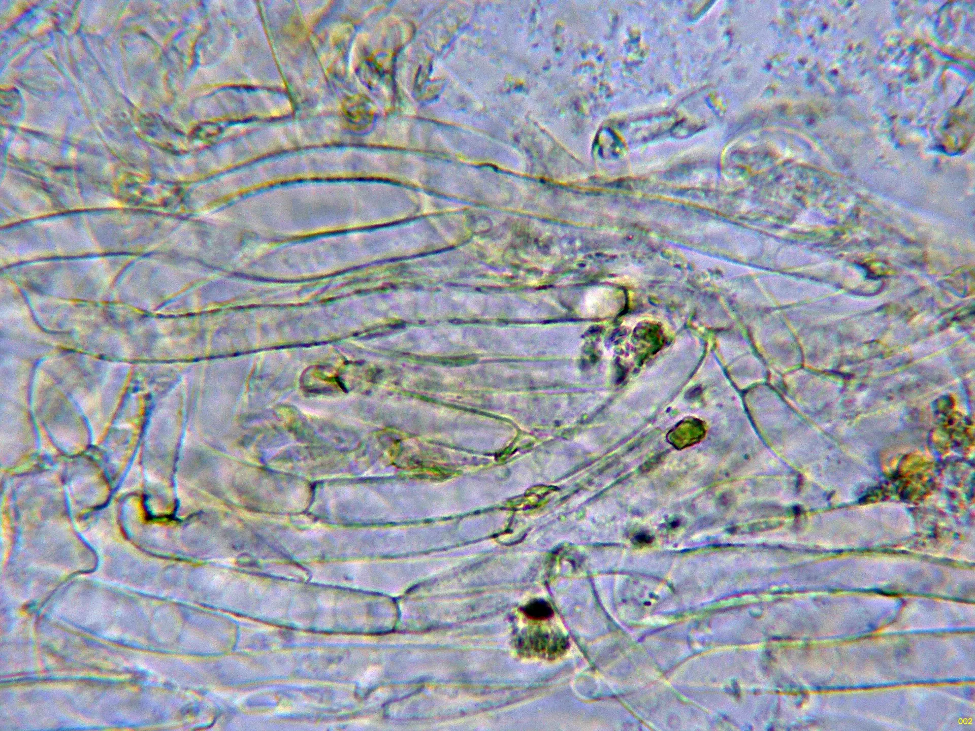 Microscopía de Protostropharia luteonitens - 10 - Subpellis agua-002